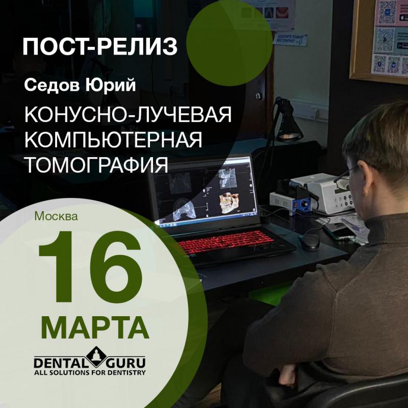 16 марта: Конусно-лучевая компьютерная томография в практике врача-стоматолога