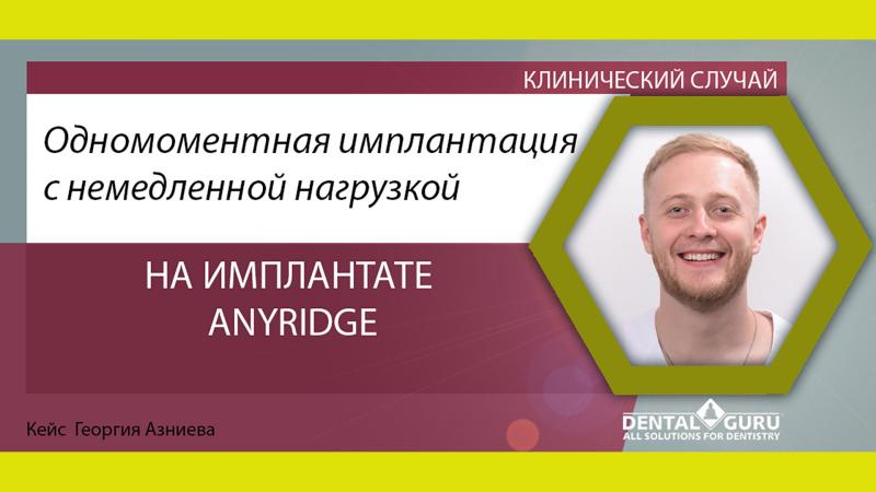 Одномоментная имплантация с немедленной нагрузкой на имплантате AnyRidge. Кейс Георгия Азниева