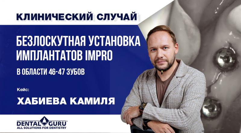 Безлоскутная установка имплантатов IMPRO в области 46–47 зубов