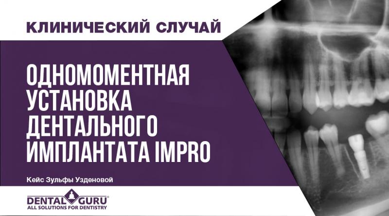 Одномоментная установка дентального имплантата Impro 