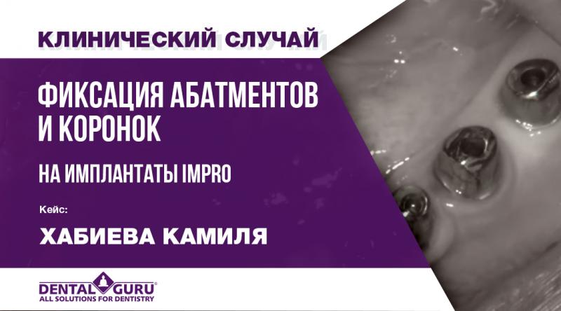 Фиксация абатментов и коронок на имплантаты IMPRO