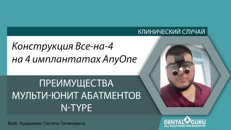 Конструкция Все-на-4 на 4 имплантатах AnyOne