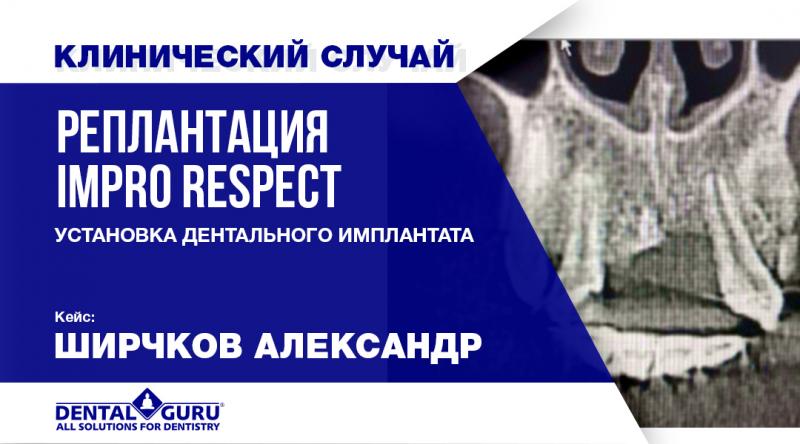 Реплантация Impro Respect