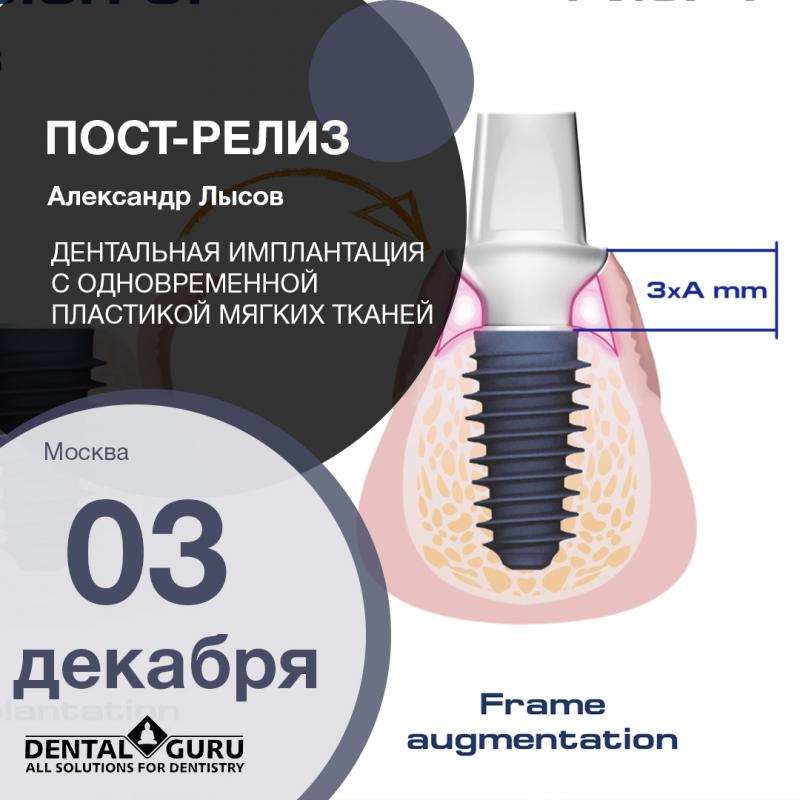 Дентальная имплантация с одновременной пластикой мягких тканей в сложных клинических случаях