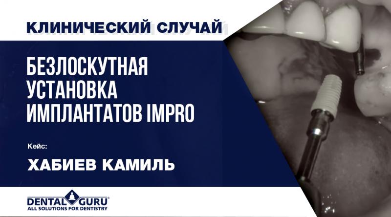 Безлоскутная установка имплантатов IMPRO