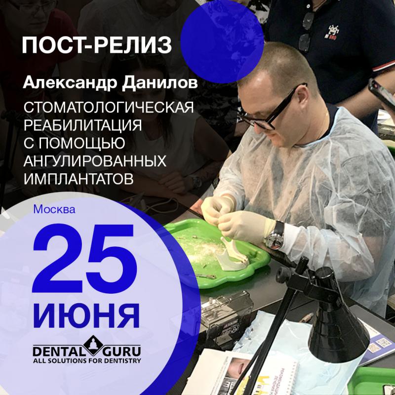 25.06.2021 Стоматологическая реабилитация с помощью ангулированных имплантатов. Имплантация на 4-х имплантатах. Физиологическое и анатомическое обоснование