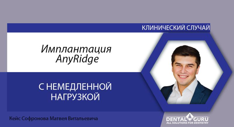 Имплантация AnyRidge с немедленной нагрузкой