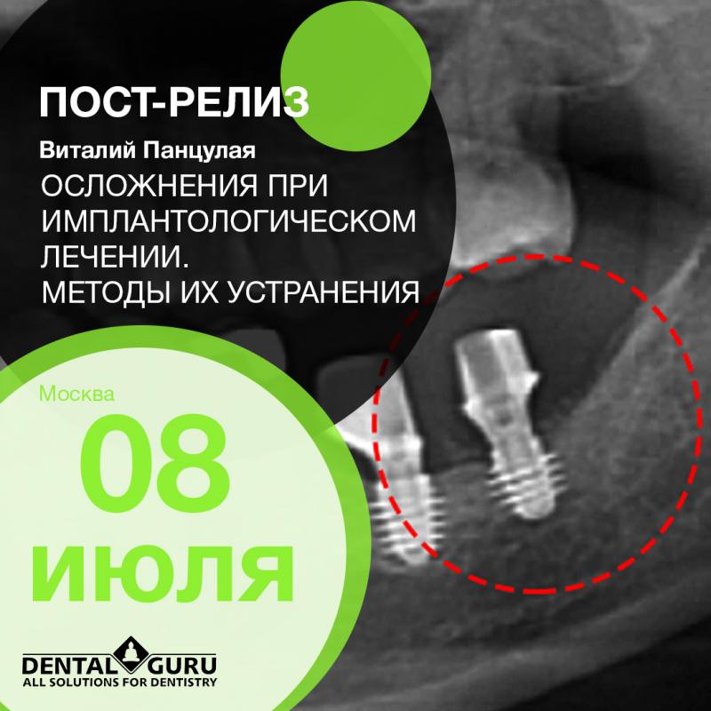 Осложнения при имплантологическом лечении. Методы их устранения