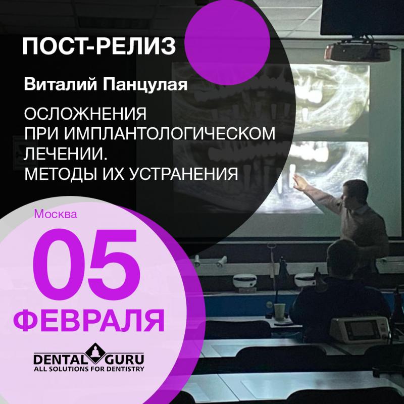 Пост-релиз 5 февраля: «Осложнения при имплантологическом лечении. Методы их устранения»