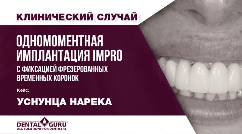 Одномоментная установка дентальных имплантатов Impro с фиксацией фрезерованных временных коронок