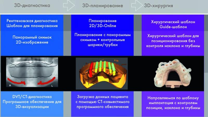 Цифровая техника для безопасного немедленного протезирования