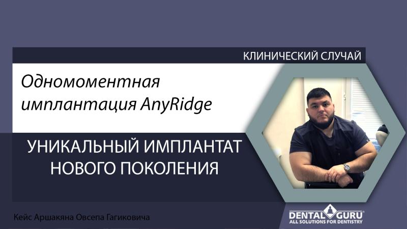 Одномоментная имплантация AnyRidge. Кейс доктора Овсепа Аршакяна.