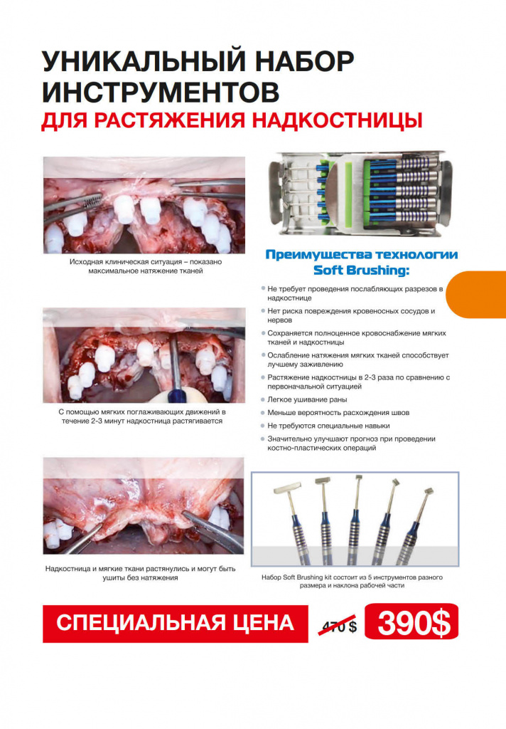 Уникальный набор инструментов для растяжения надкостницы Soft Brushing по специальной цене