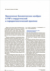 Применение биологических мембран A-PRF в хирургической и пародонтологической практике