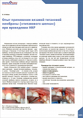 Опыт применения вязаной титановой мембраны («титанового шелка») при проведении НКР