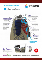 Мембрана I-Gen