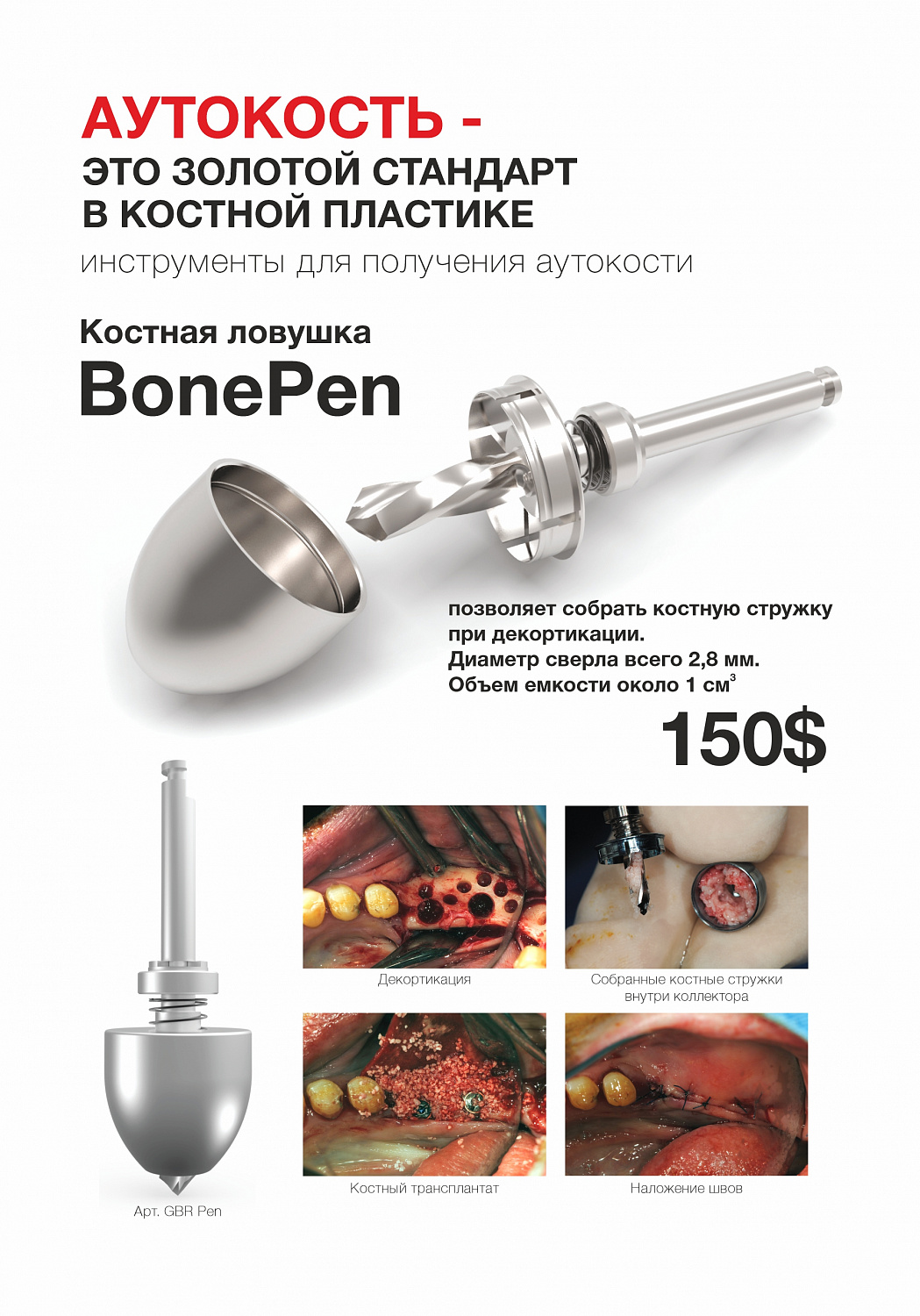 Новинка: костная ловушка BonePen