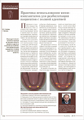 Практика использования миниимплантатов для реабилитации пациентов с полной адентией